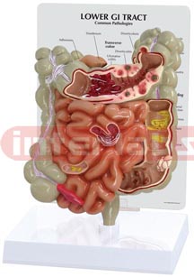 GI Tract